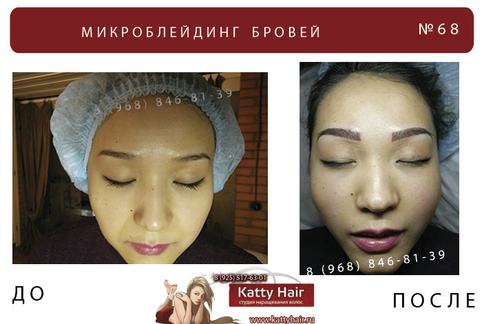 фото клиента до и после