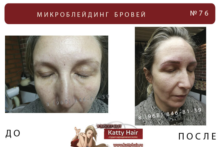 фото до и после микроблейдинг
