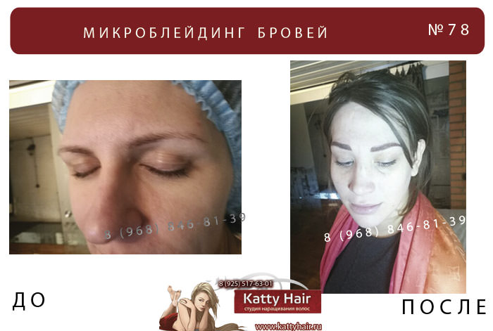 фото до и после микроблейдинг