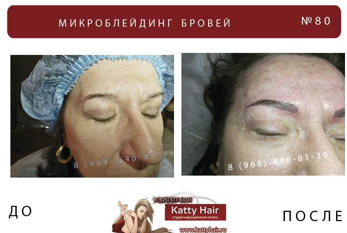 фото до и после микроблейдинг